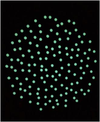 Combined Optokinetic Treatment and Vestibular Rehabilitation to Reduce Visually Induced Dizziness in a Professional Ice Hockey Player After Concussion: A Clinical Case